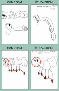 Esempio uso prismi propriocettivi